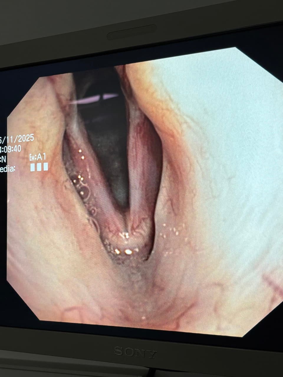 Endoscopie vétérinaire