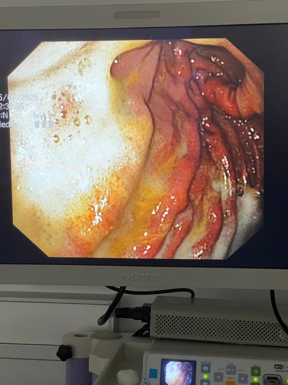Endoscopie vétérinaire