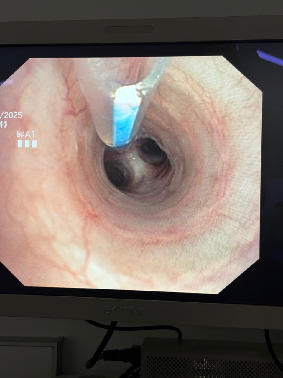Endoscopie vétérinaire